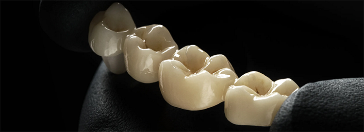 ACM02 ST COLOR block